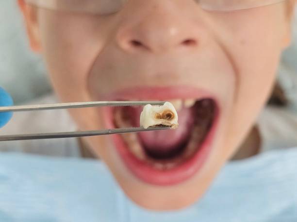 Best Emergency Treatment for Oral Infections in Dunmore, PA